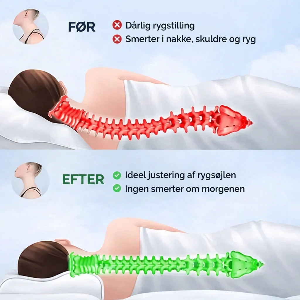 SlaapSteun™ | Ergonomisch kussen voor nek en schouders